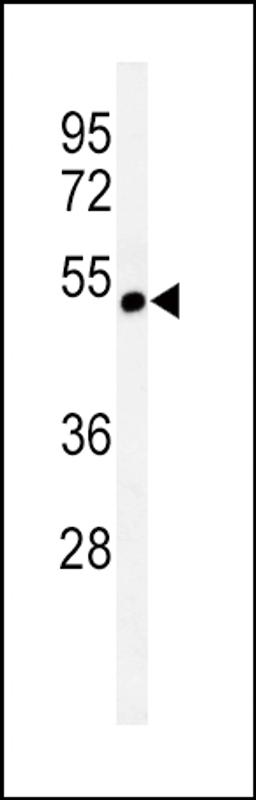 Western blot analysis of CHRNA3 Antibody in CEM cell line lysates (35ug/lane)