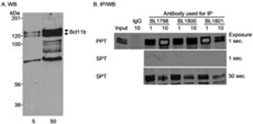 Detection of human Bcl11b by western blot and immunoprecipitation.