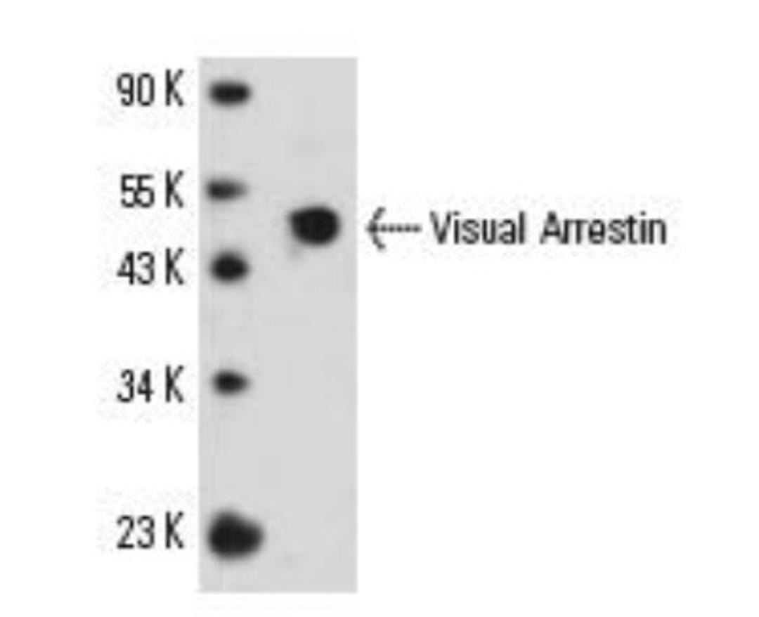 Western Blot: S-arrestin Antibody (PDS-1) [NB100-2385] - Western blot analysis of Visual Arrestin expression in human retina tissue extract.