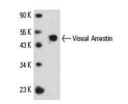 Western Blot: S-arrestin Antibody (PDS-1) [NB100-2385] - Western blot analysis of Visual Arrestin expression in human retina tissue extract.