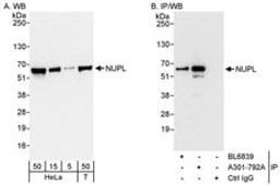 Detection of human NUPL by western blot and immunoprecipitation.