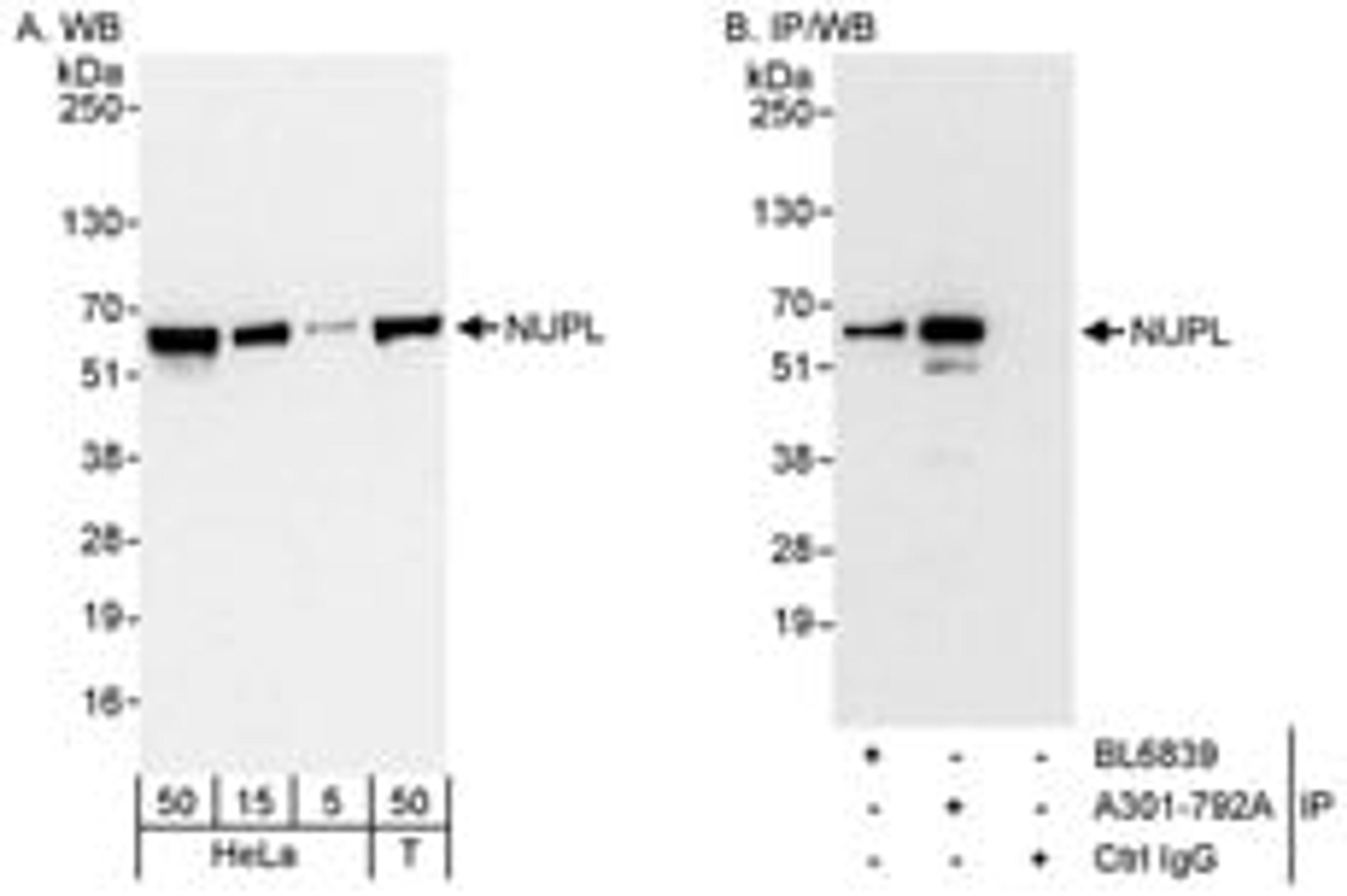 Detection of human NUPL by western blot and immunoprecipitation.