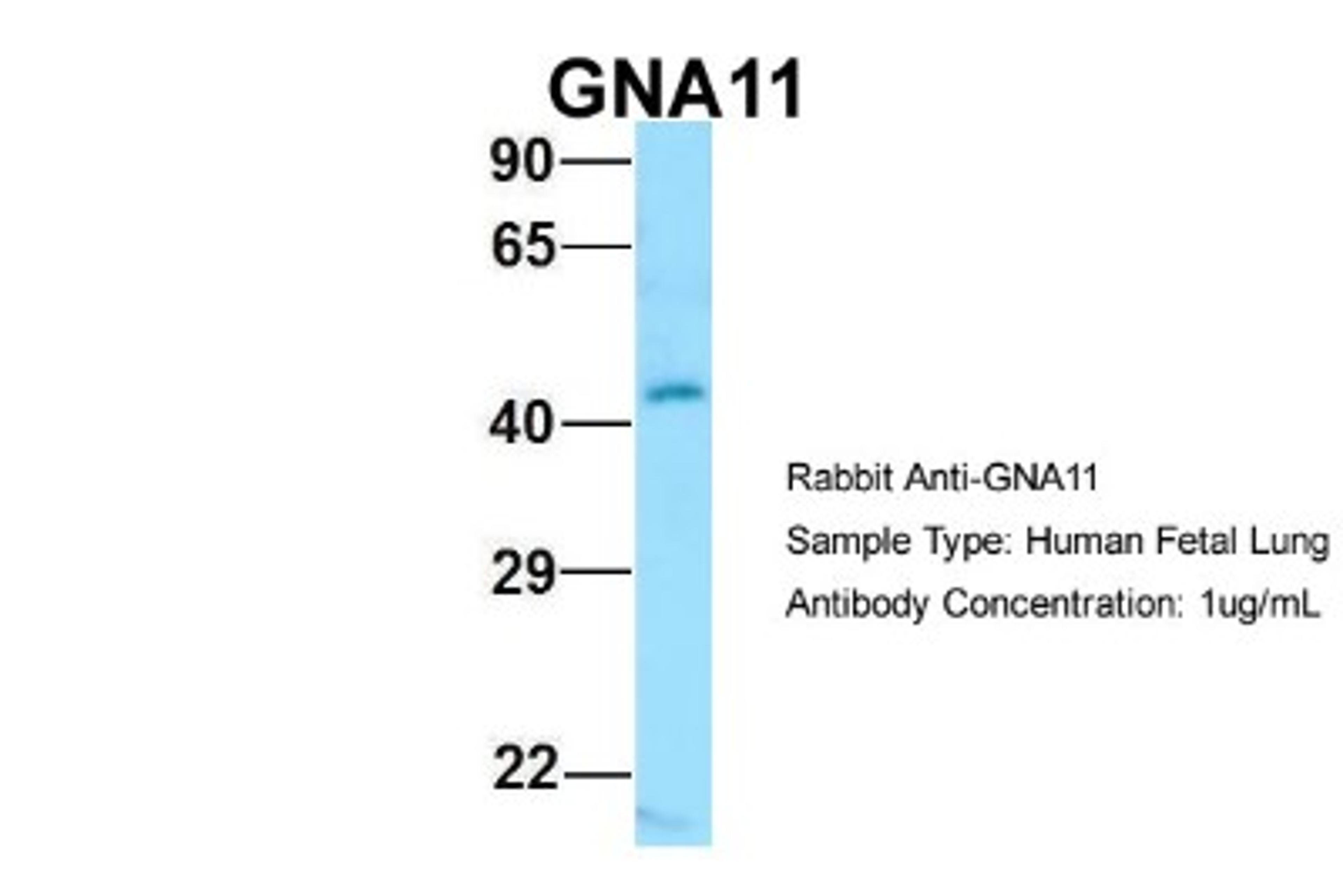 Western Blot: GNA11 Antibody [NBP1-98606] - Human Fetal Lung, Antibody Dilution: 1.0 ug/ml.