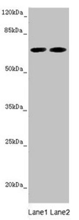 Western blot. All lanes: STXBP2 antibody at 5.88µg/ml. Lane 1: Mouse brain tissue. Lane 2: A549 whole cell lysate. Secondary. Goat polyclonal to rabbit IgG at 1/10000 dilution. Predicted band size: 67, 68 kDa. Observed band size: 67 kDa