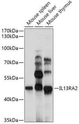 Western blot - IL13RA2 antibody (A2043)