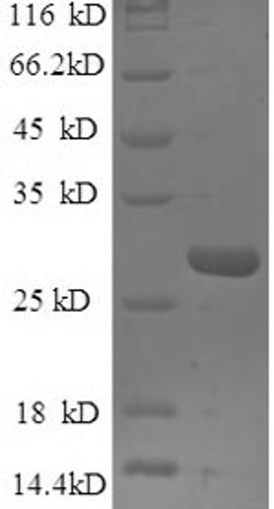 (Tris-Glycine gel) Discontinuous SDS-PAGE (reduced) with 5% enrichment gel and 15% separation gel.