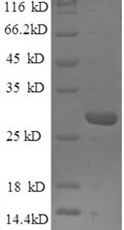 (Tris-Glycine gel) Discontinuous SDS-PAGE (reduced) with 5% enrichment gel and 15% separation gel.