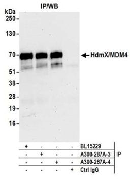 Detection of human HdmX/MDM4 by western blot of immunoprecipitates.