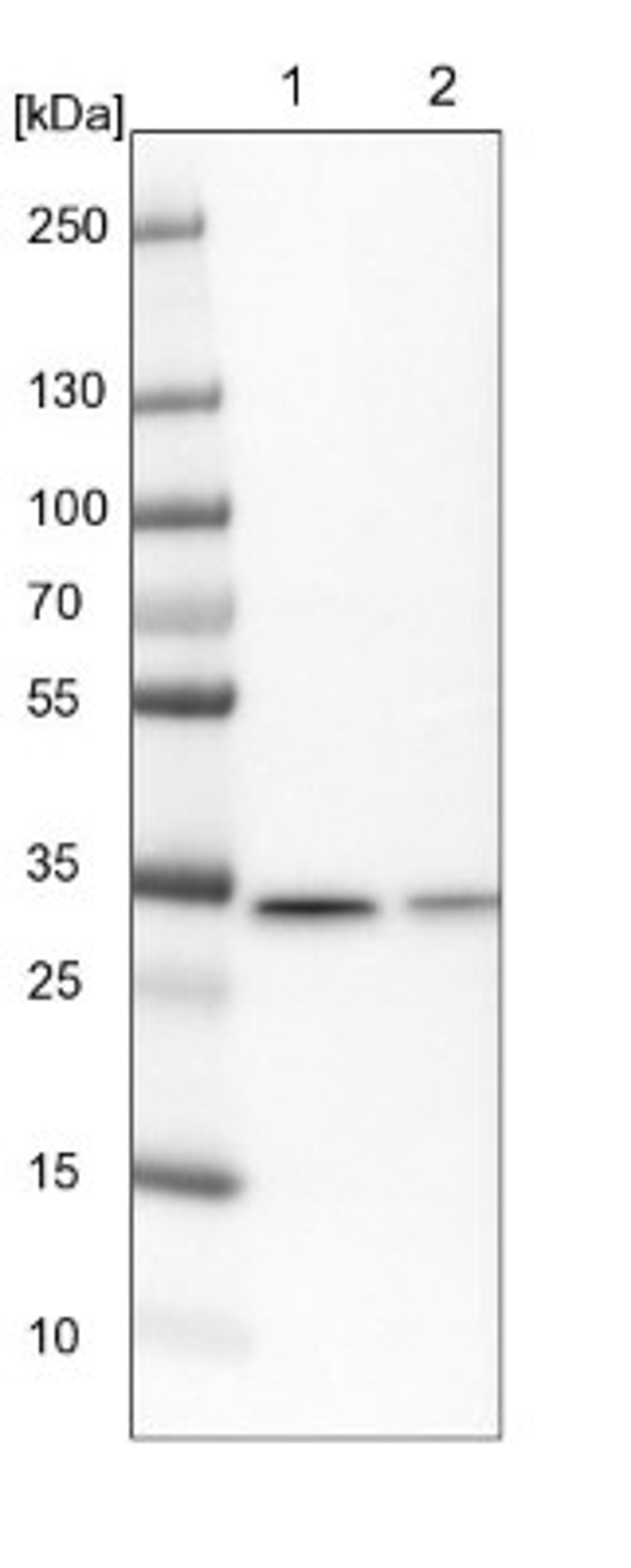 Western Blot: CIP29 Antibody [NBP1-91788] - Lane 1: NIH-3T3 cell lysate (Mouse embryonic fibroblast cells)<br/>Lane 2: NBT-II cell lysate (Rat Wistar bladder tumour cells)