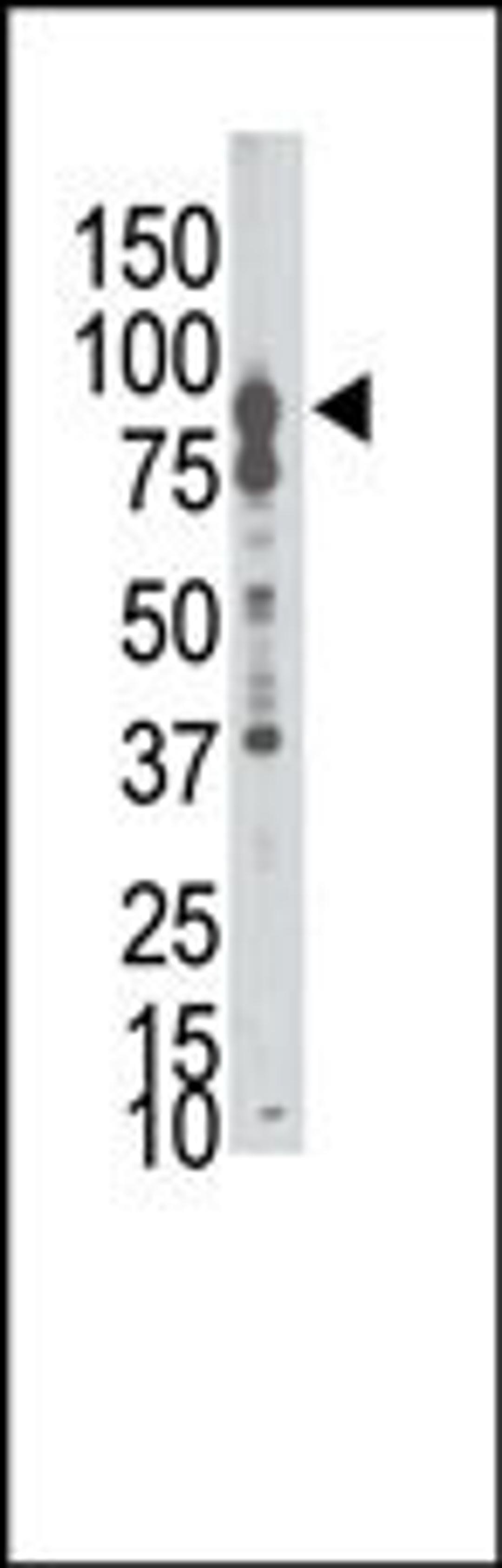 Western blot analysis of anti-EphB6 N-term Pab in A549 cell lysate