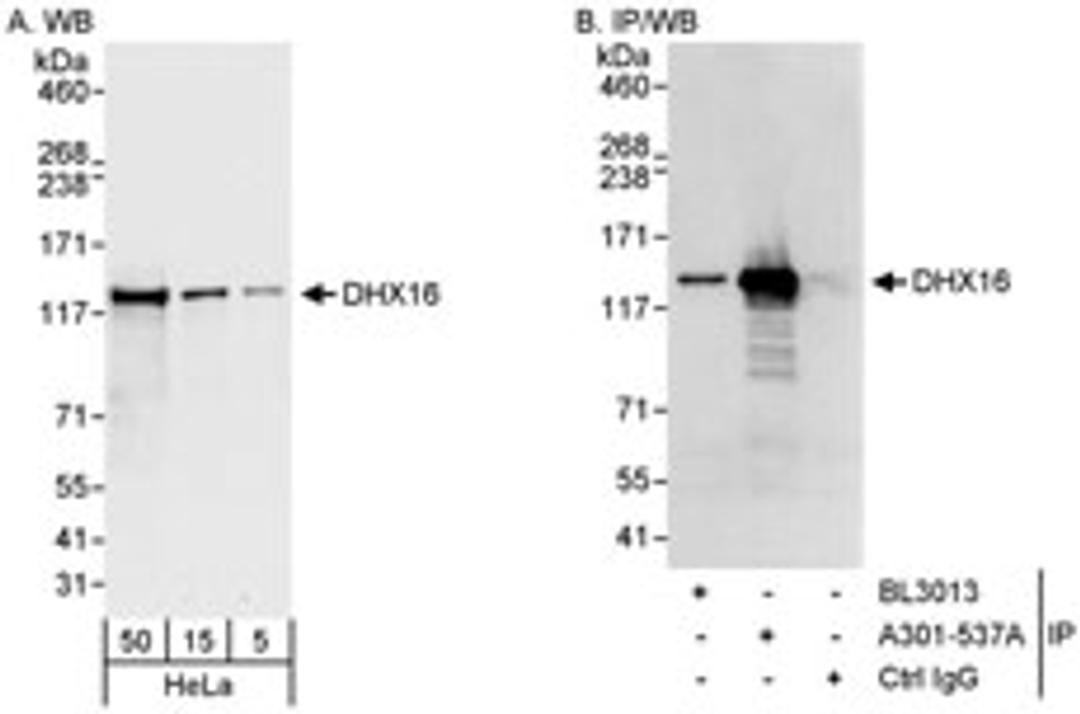 Detection of human DHX16 by western blot and immunoprecipitation.