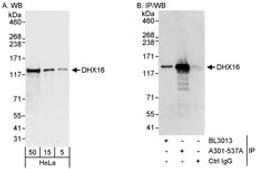 Detection of human DHX16 by western blot and immunoprecipitation.