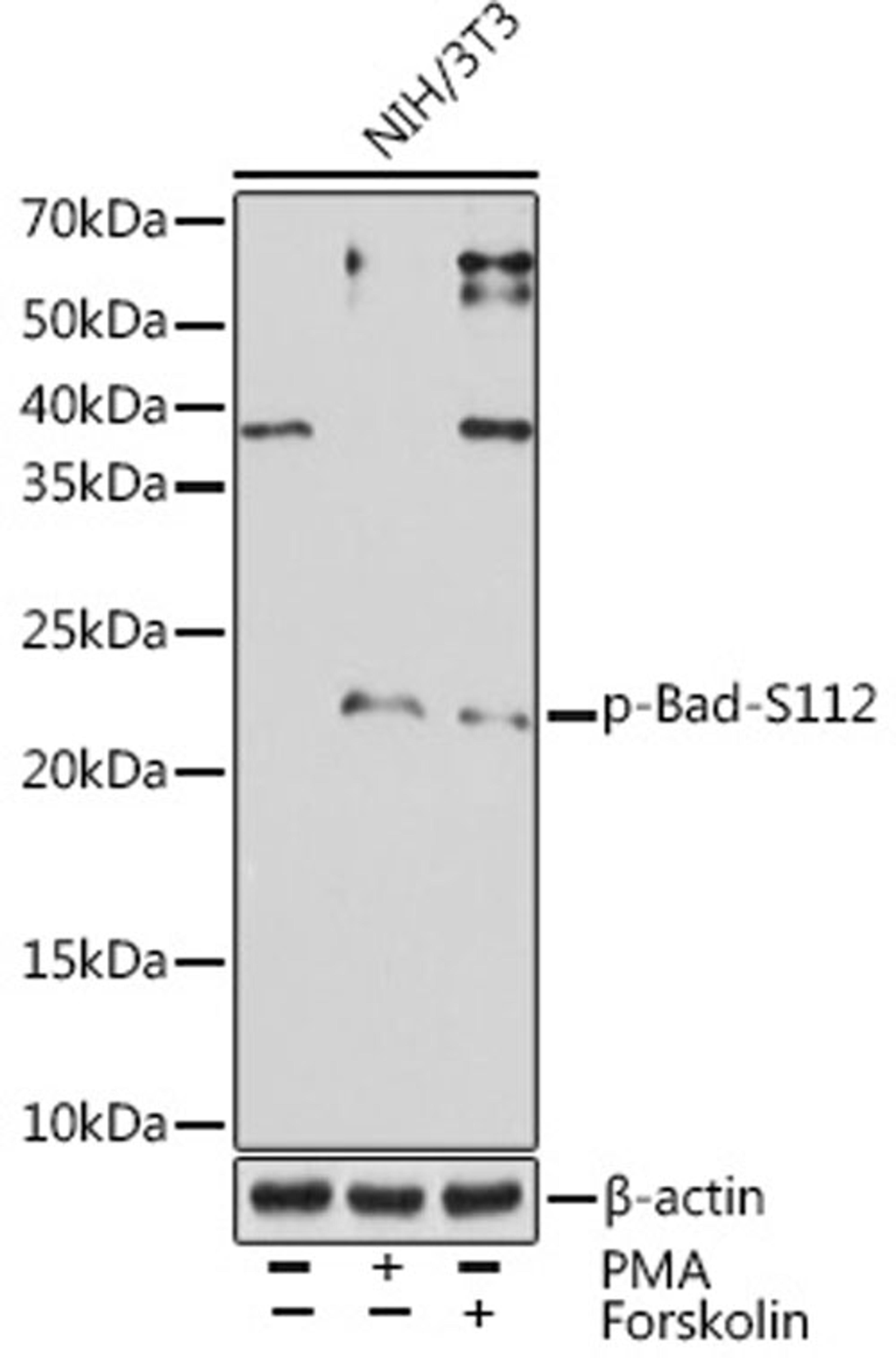 Western blot - Phospho-Bad-S112 Rabbit mAb (AP1010)