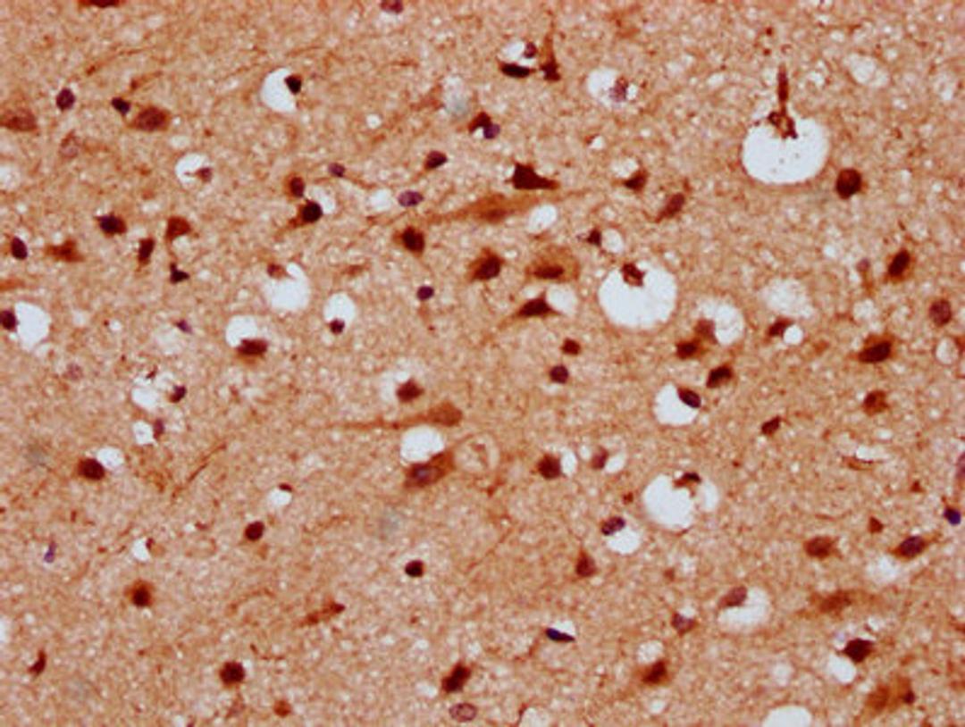 IHC image of CSB-PA22879A0Rb diluted at 1:300 and staining in paraffin-embedded human brain tissue performed on a Leica BondTM system. After dewaxing and hydration, antigen retrieval was mediated by high pressure in a citrate buffer (pH 6.0). Section was blocked with 10% normal goat serum 30min at RT. Then primary antibody (1% BSA) was incubated at 4&deg;C overnight. The primary is detected by a biotinylated secondary antibody and visualized using an HRP conjugated SP system.