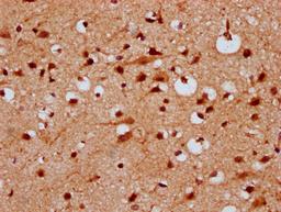 IHC image of CSB-PA22879A0Rb diluted at 1:300 and staining in paraffin-embedded human brain tissue performed on a Leica BondTM system. After dewaxing and hydration, antigen retrieval was mediated by high pressure in a citrate buffer (pH 6.0). Section was blocked with 10% normal goat serum 30min at RT. Then primary antibody (1% BSA) was incubated at 4&deg;C overnight. The primary is detected by a biotinylated secondary antibody and visualized using an HRP conjugated SP system.