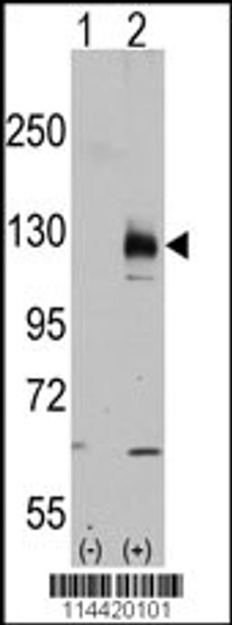 Western blot analysis of TRPM8 using rabbit polyclonal.293 cell lysates (2 ug/lane) either nontransfected (Lane 1) or transiently transfected with the TRPM8 gene (Lane 2).