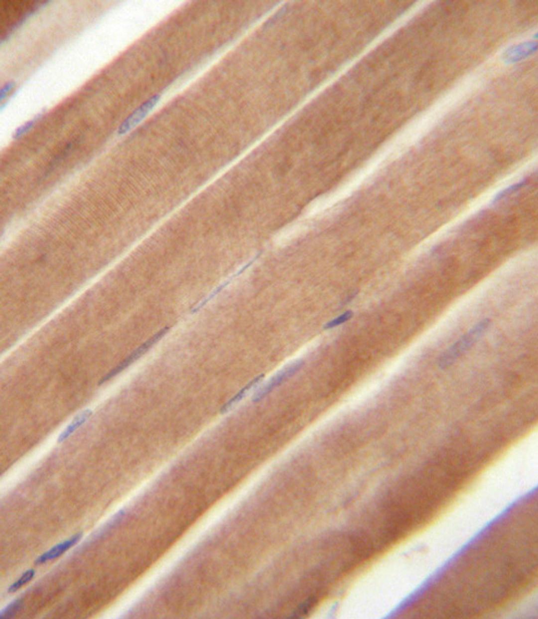 EphB2 Antibody (N-term)immunohistochemistry analysis in formalin fixed and paraffin embedded human skeletal muscle followed by peroxidase conjugation of the secondary antibody and DAB staining.