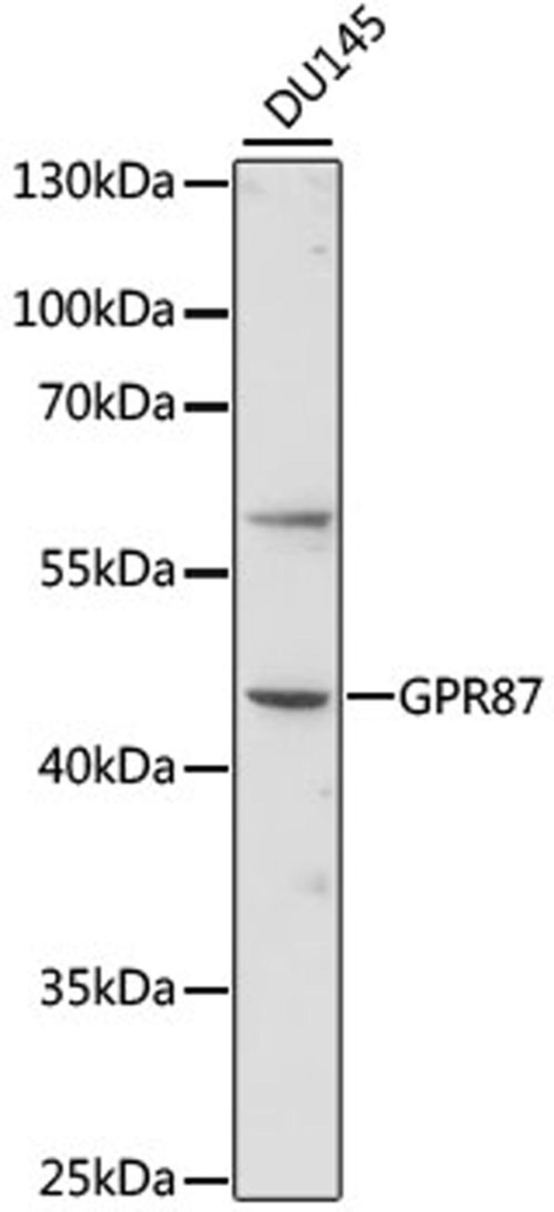 Western blot - GPR87 antibody (A15162)