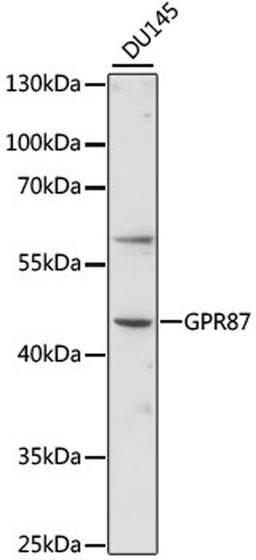 Western blot - GPR87 antibody (A15162)