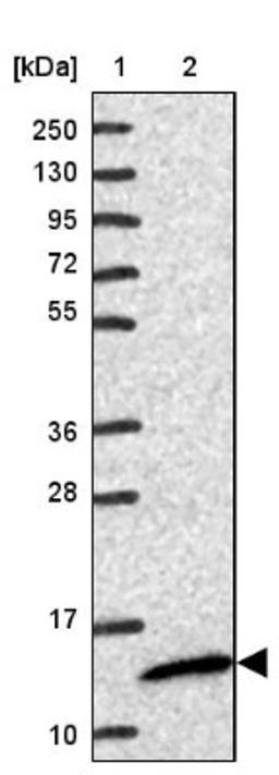 Western Blot: HSPC268 Antibody [NBP2-31902] - Lane 1: Marker [kDa] 250, 130, 95, 72, 55, 36, 28, 17, 10<br/>Lane 2: Human cell line RT-4