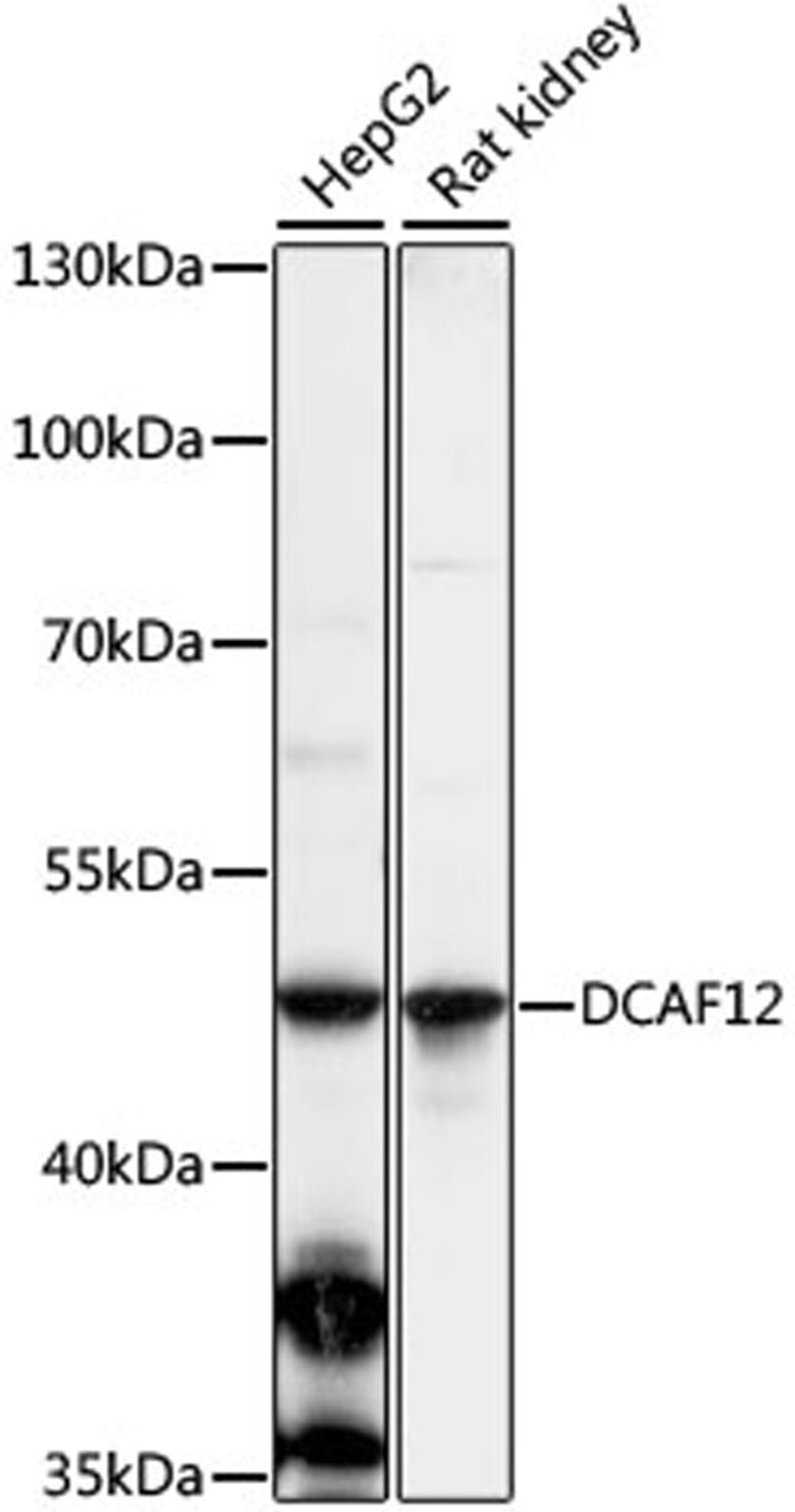 Western blot - DCAF12 antibody (A16510)