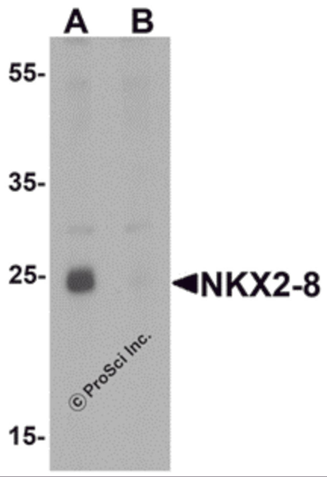 Western blot analysis of NKX2-8 in rat liver tissue lysate with NKX2-8 antibody at 1 &#956;g/mL in (A) the absence and (B) the presence of blocking peptide