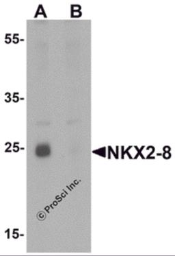 Western blot analysis of NKX2-8 in rat liver tissue lysate with NKX2-8 antibody at 1 μg/mL in (A) the absence and (B) the presence of blocking peptide