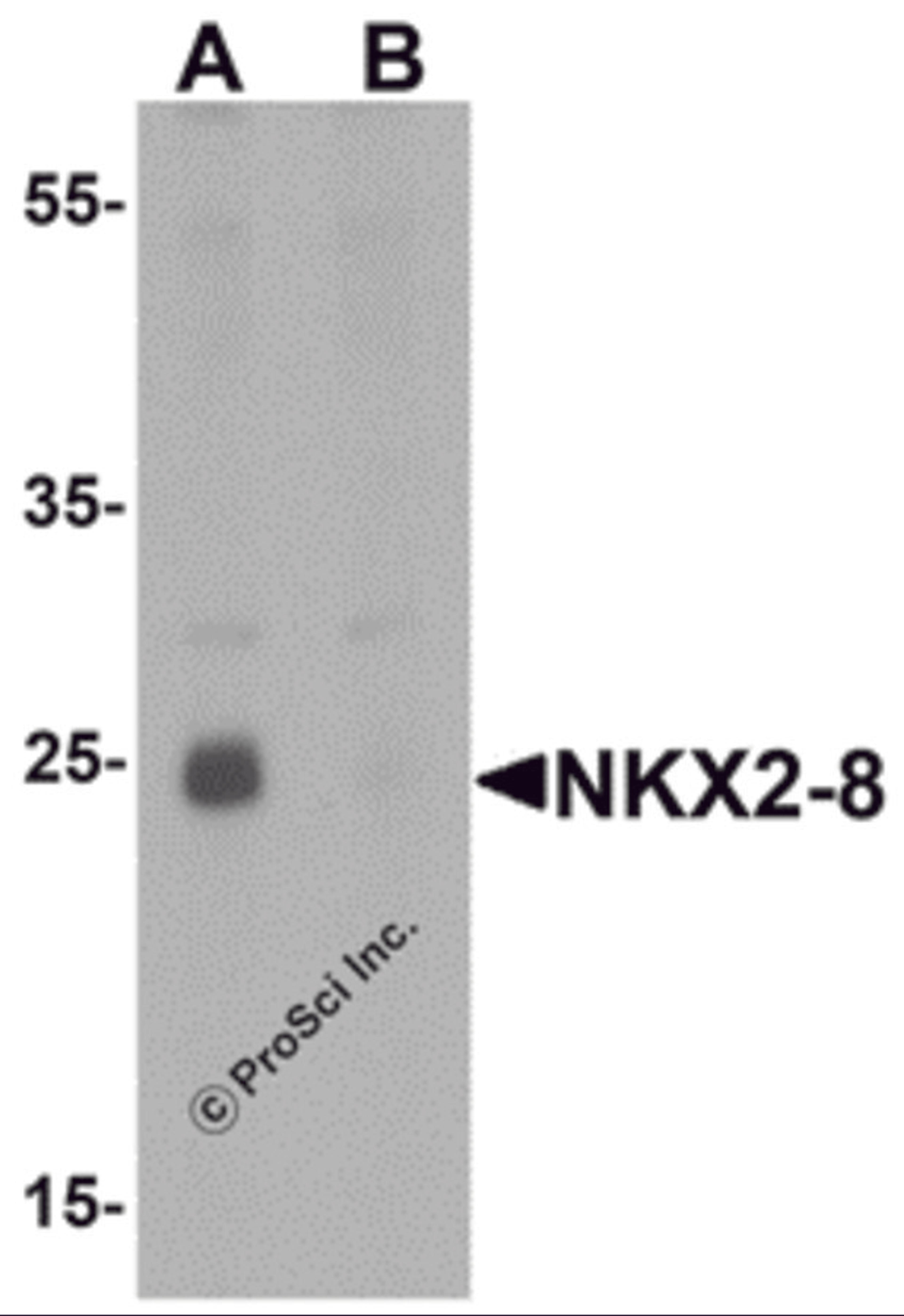 Western blot analysis of NKX2-8 in rat liver tissue lysate with NKX2-8 antibody at 1 μg/mL in (A) the absence and (B) the presence of blocking peptide