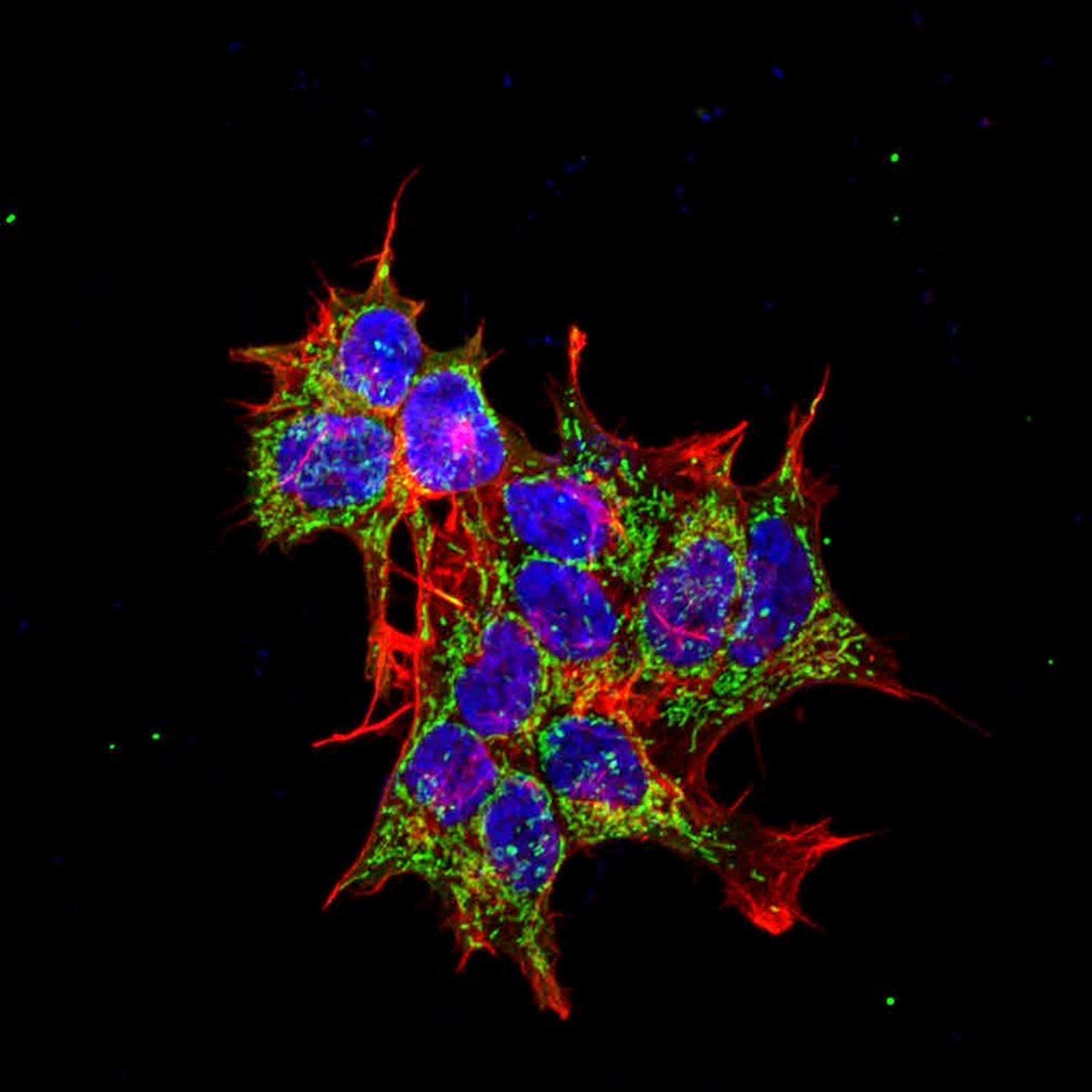 Immunofluorescence analysis of neuroblastoma cell line sk-n-be using REEP2 antibody