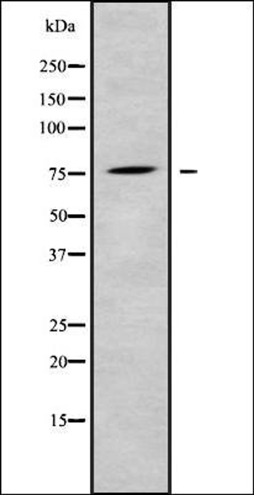 Western blot analysis of K562 whole cell lysates using LRP10 antibody