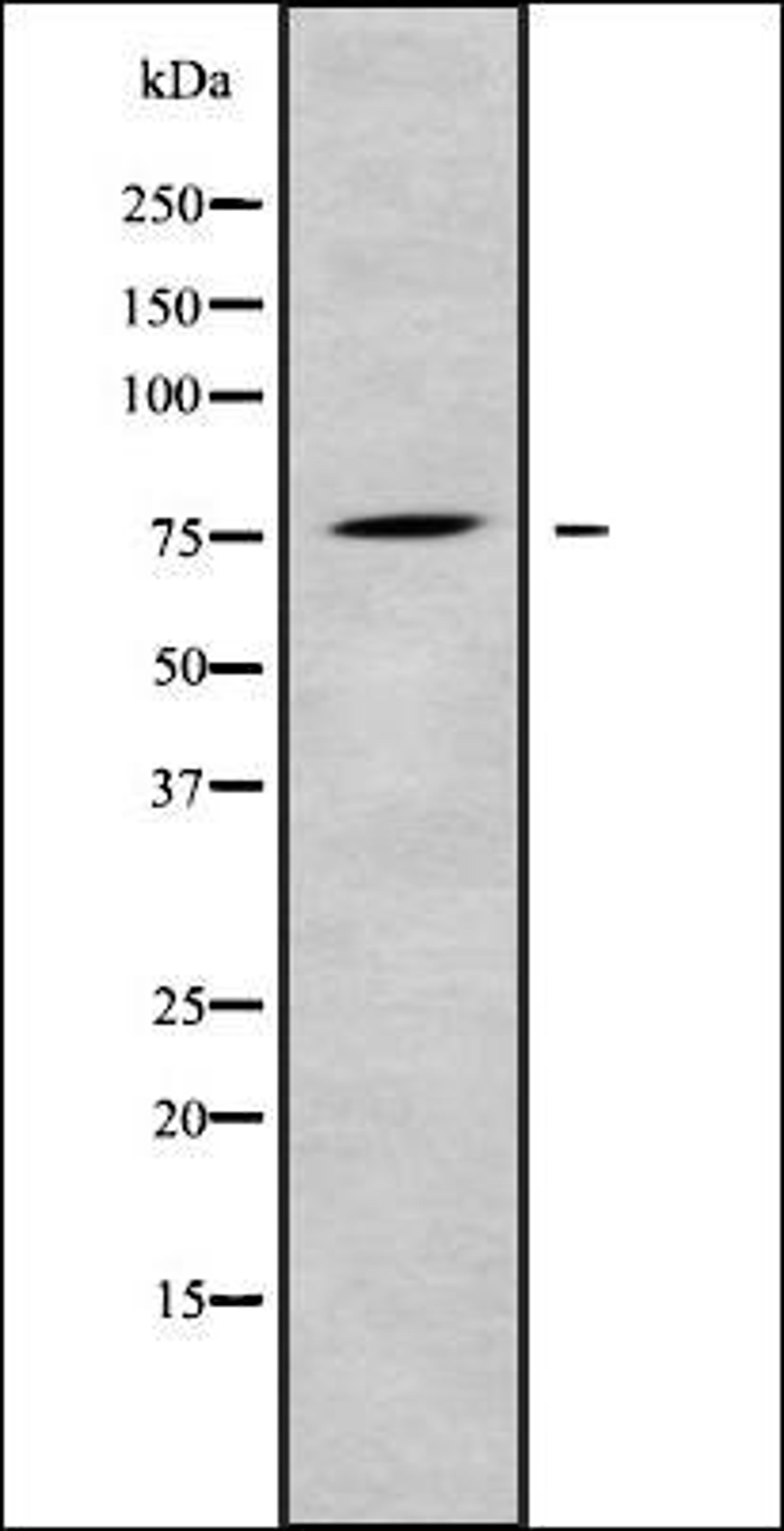 Western blot analysis of K562 whole cell lysates using LRP10 antibody