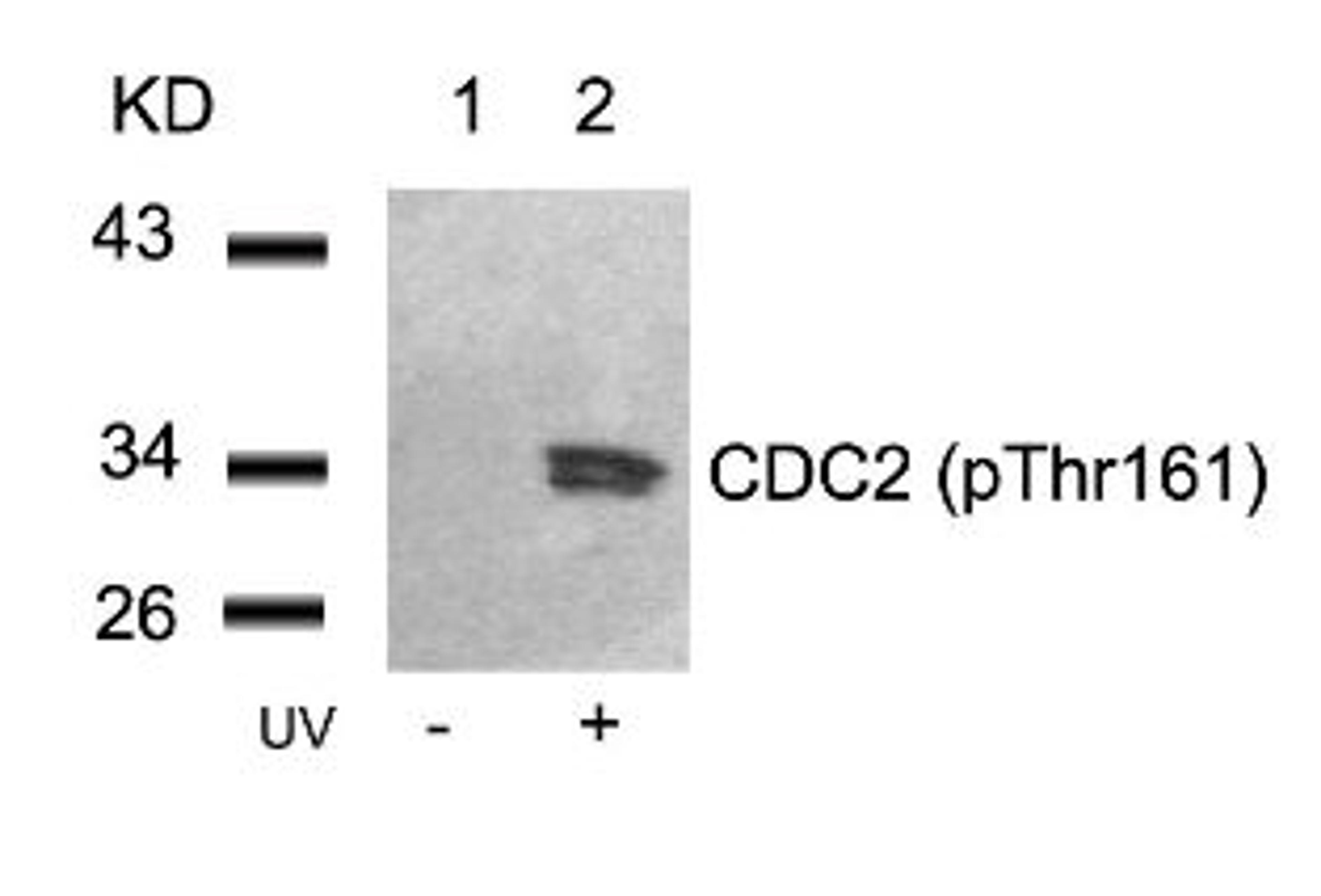 Western blot analysis of lysed extracts from HeLa cells untreated (Lane 1) or treated with UV (lane 2) using CDC2 (Phospho-Thr161).