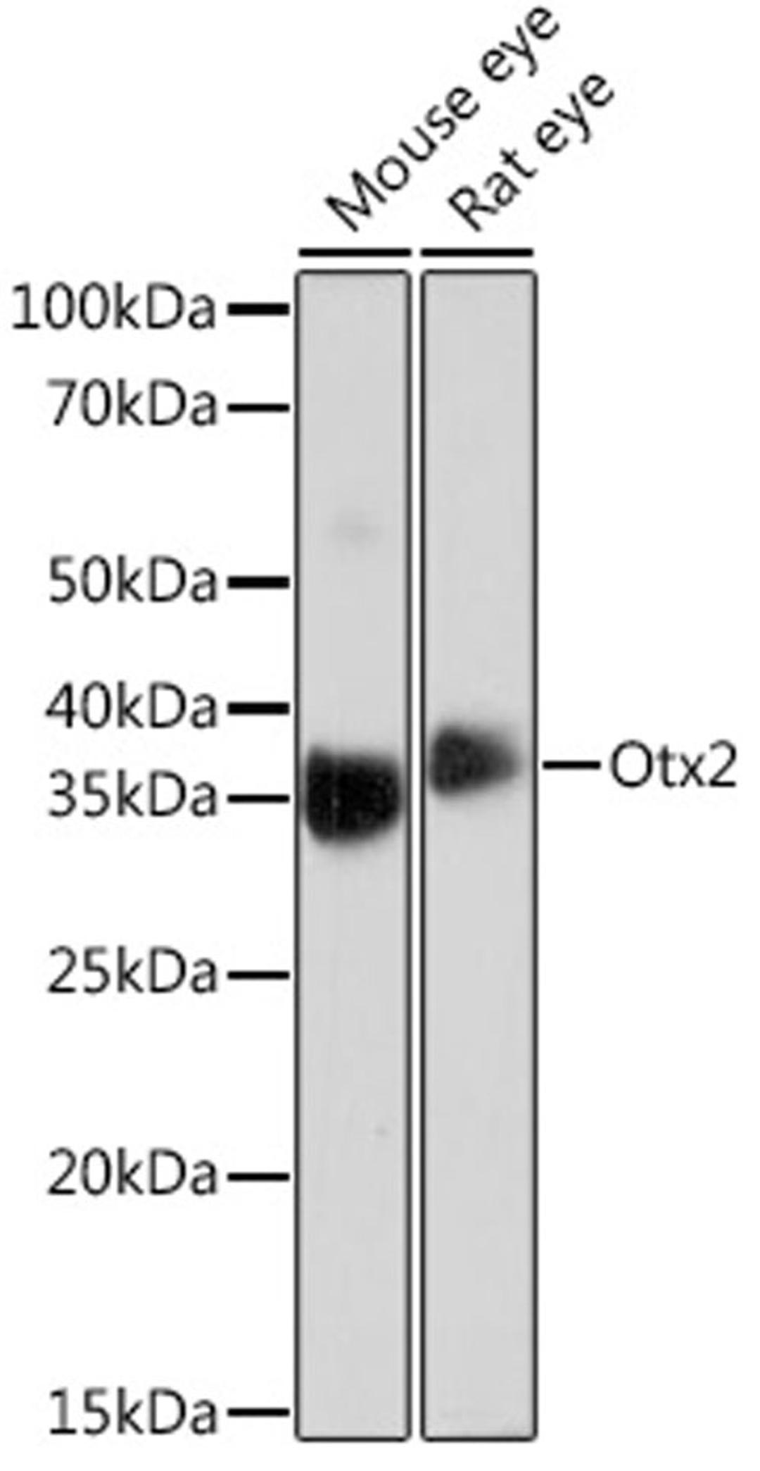 Western blot - Otx2 Rabbit mAb (A4351)