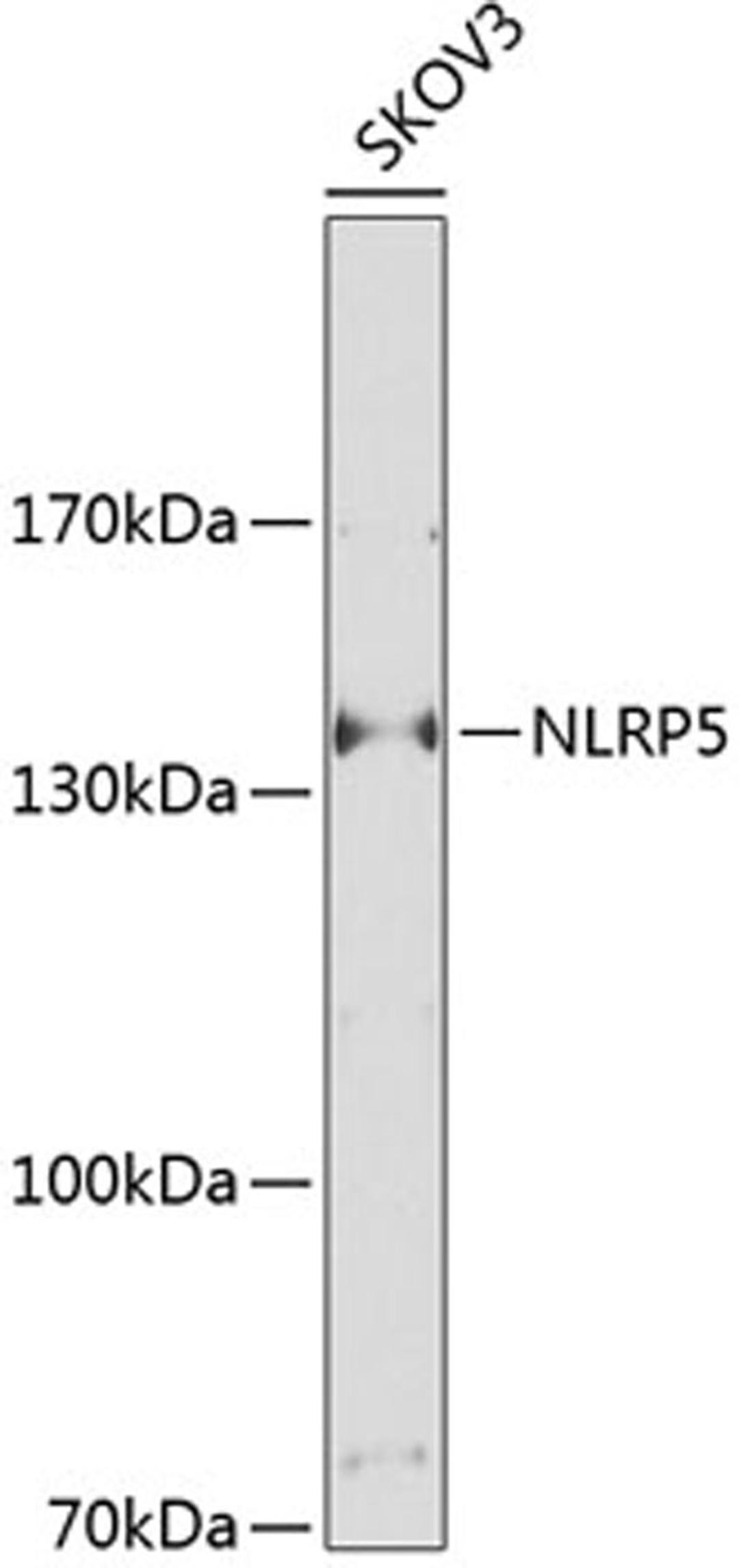 Western blot - NLRP5 Antibody (A9886)