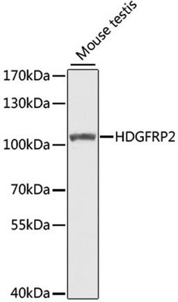 Western blot - HDGFRP2 antibody (A7484)