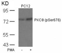 Western blot analysis of lysed extracts from PC12 cells untreated or treated with PMA using PKC&#920; (Phospho-Ser676).