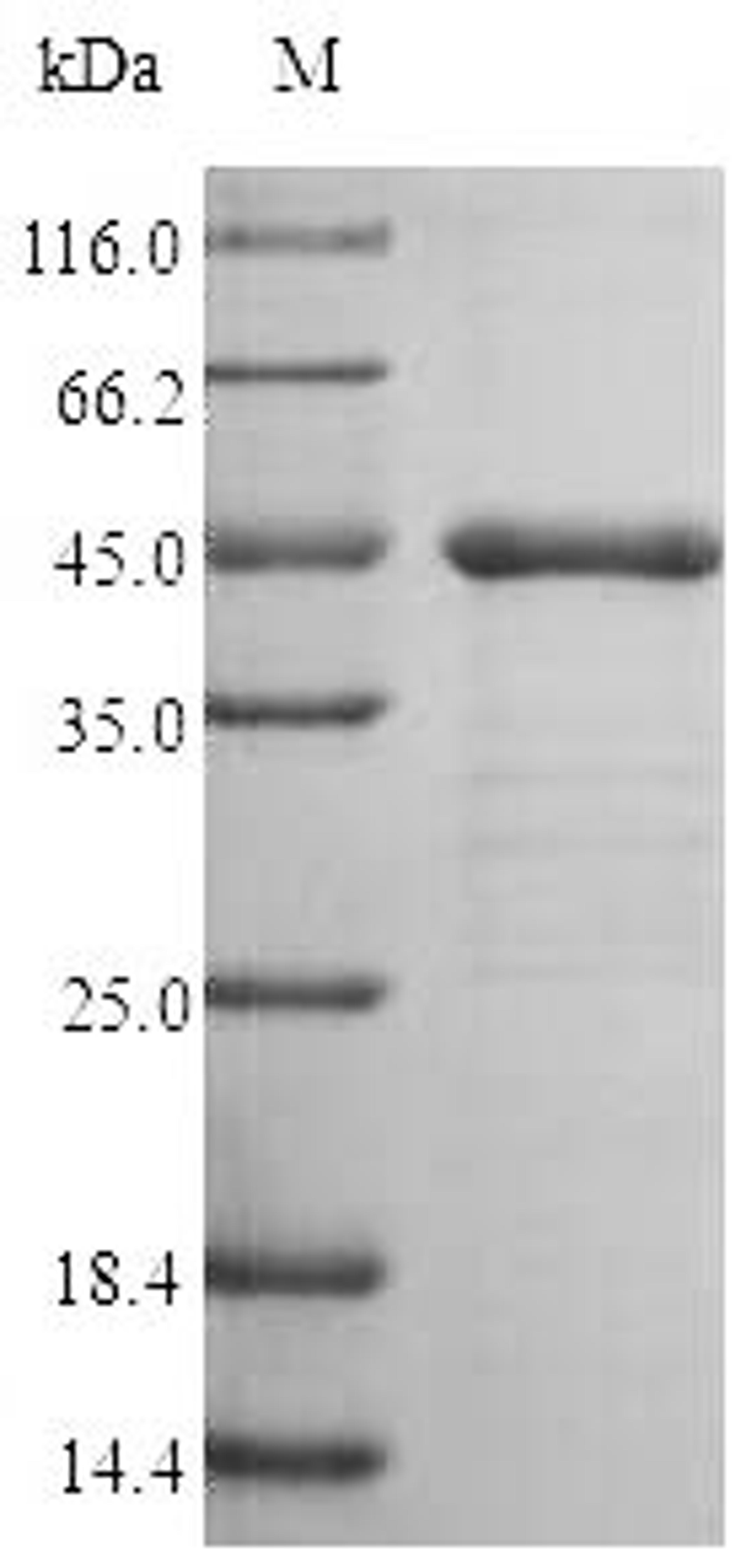(Tris-Glycine gel) Discontinuous SDS-PAGE (reduced) with 5% enrichment gel and 15% separation gel.