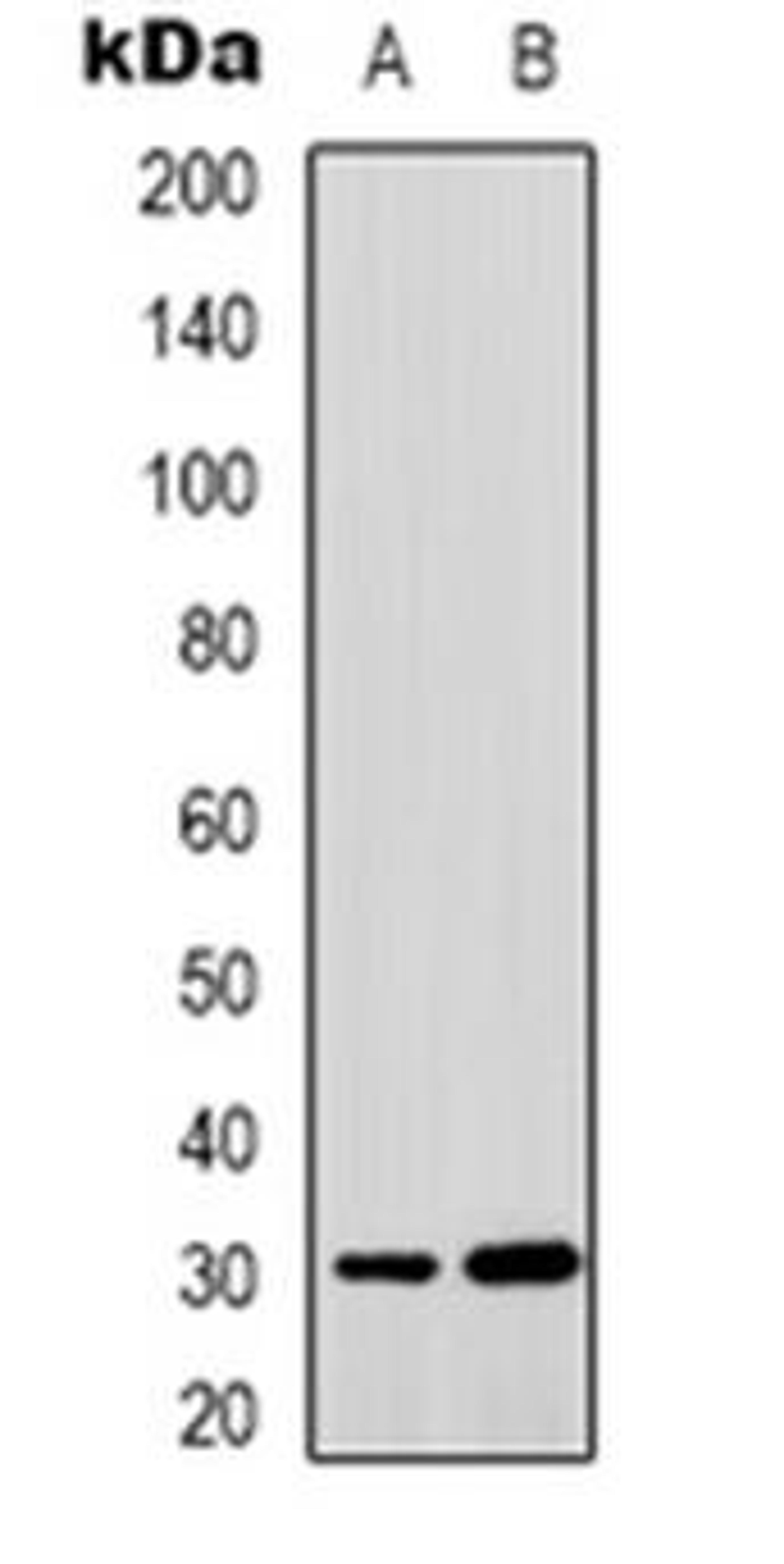 Western blot analysis of MTIF3 expression in HepG2 (Lane 1), HUVEC (Lane 2) whole cell lysates using MTIF3 antibody