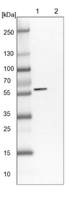 Western Blot: LACE1 Antibody [NBP1-89215] - Lane 1: NIH-3T3 cell lysate (Mouse embryonic fibroblast cells)<br/>Lane 2: NBT-II cell lysate (Rat Wistar bladder tumour cells)