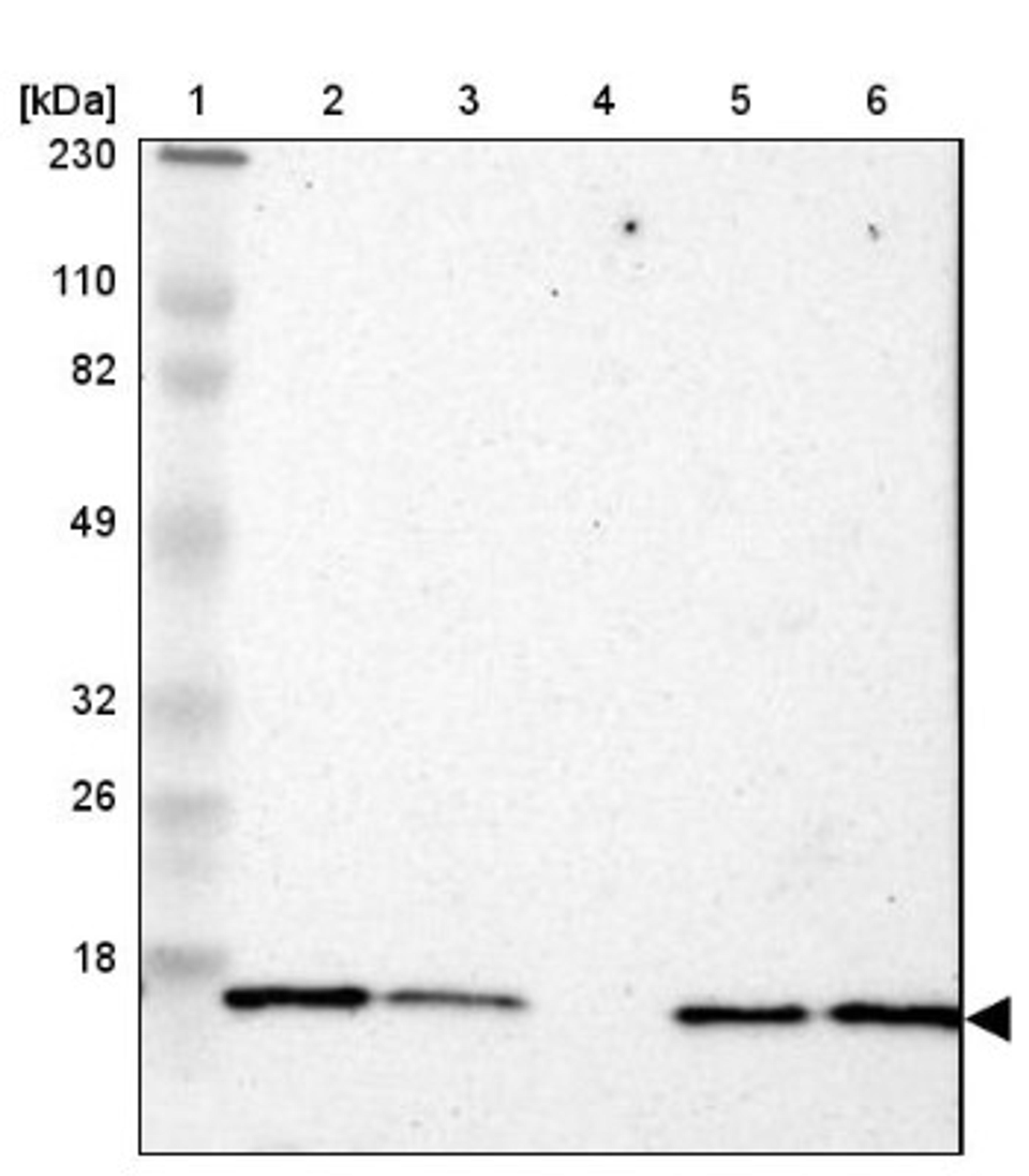 Western Blot: RPLP1 Antibody [NBP1-81293] - Lane 1: Marker [kDa] 230, 110, 82, 49, 32, 26, 18<br/>Lane 2: Human cell line RT-4<br/>Lane 3: Human cell line U-251MG sp<br/>Lane 4: Human plasma (IgG/HSA depleted)<br/>Lane 5: Human liver tissue<br/>Lane 6: Human tonsil tissue