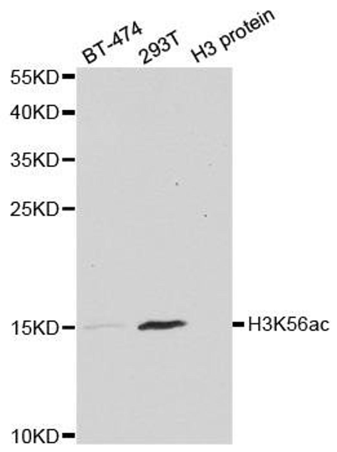 Western blot analysis of extracts of various cell lines and H3 protein expressed in E.coli. using Acetyl-Histone H3-K56 antibody