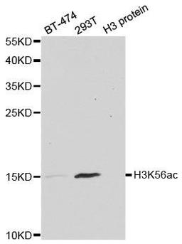 Western blot analysis of extracts of various cell lines and H3 protein expressed in E.coli. using Acetyl-Histone H3-K56 antibody