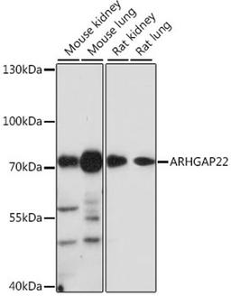 Western blot - ARHGAP22 antibody (A16566)