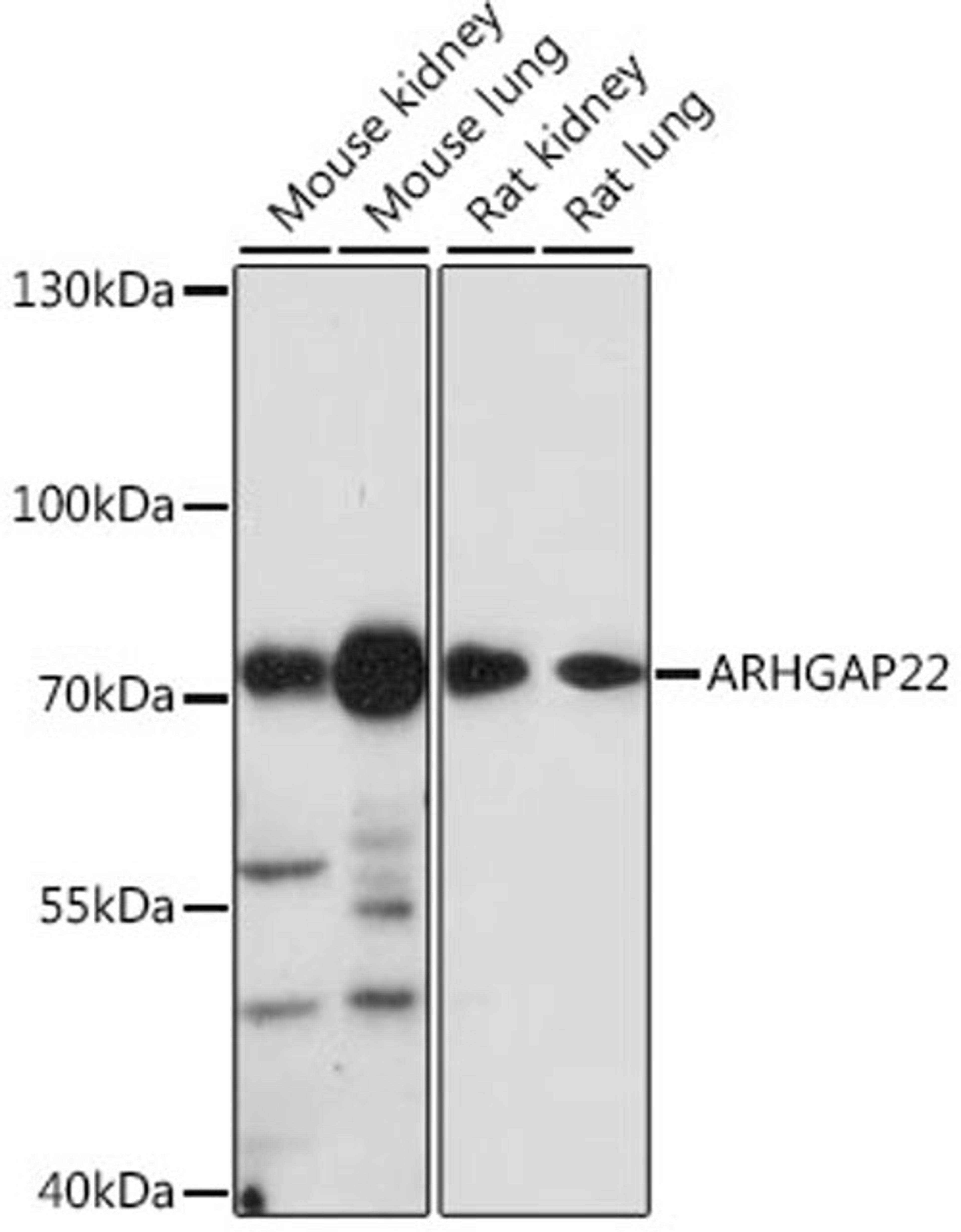 Western blot - ARHGAP22 antibody (A16566)