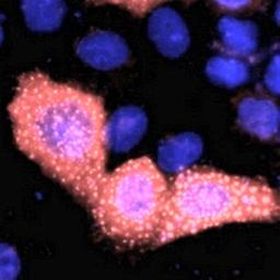 Immunofluorescense analysis of 293T cells transfected with a VSV-G-tag protein using VSV-G-tag antibody