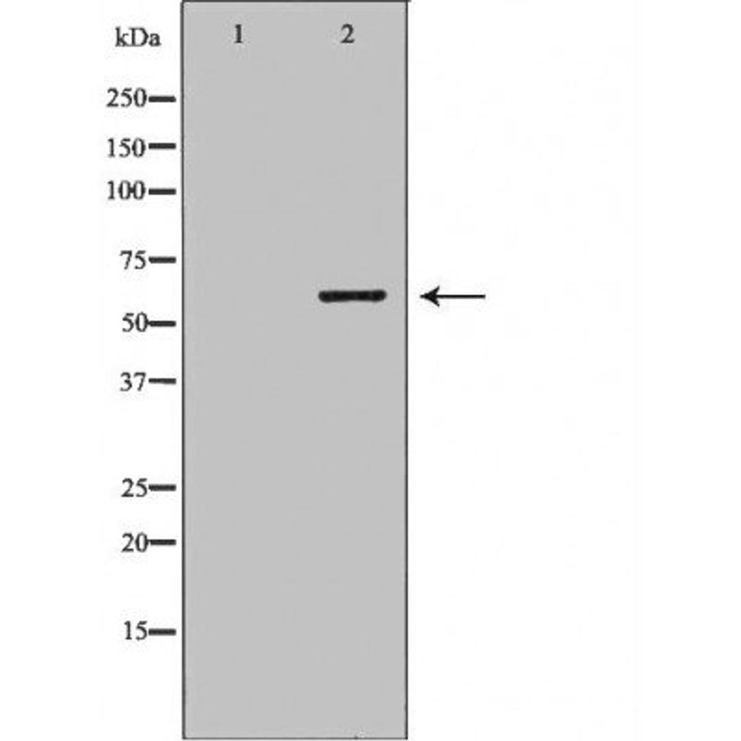 Western blot analysis of various cell lines using PSMD3 antibody