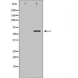 Western blot analysis of various cell lines using PSMD3 antibody