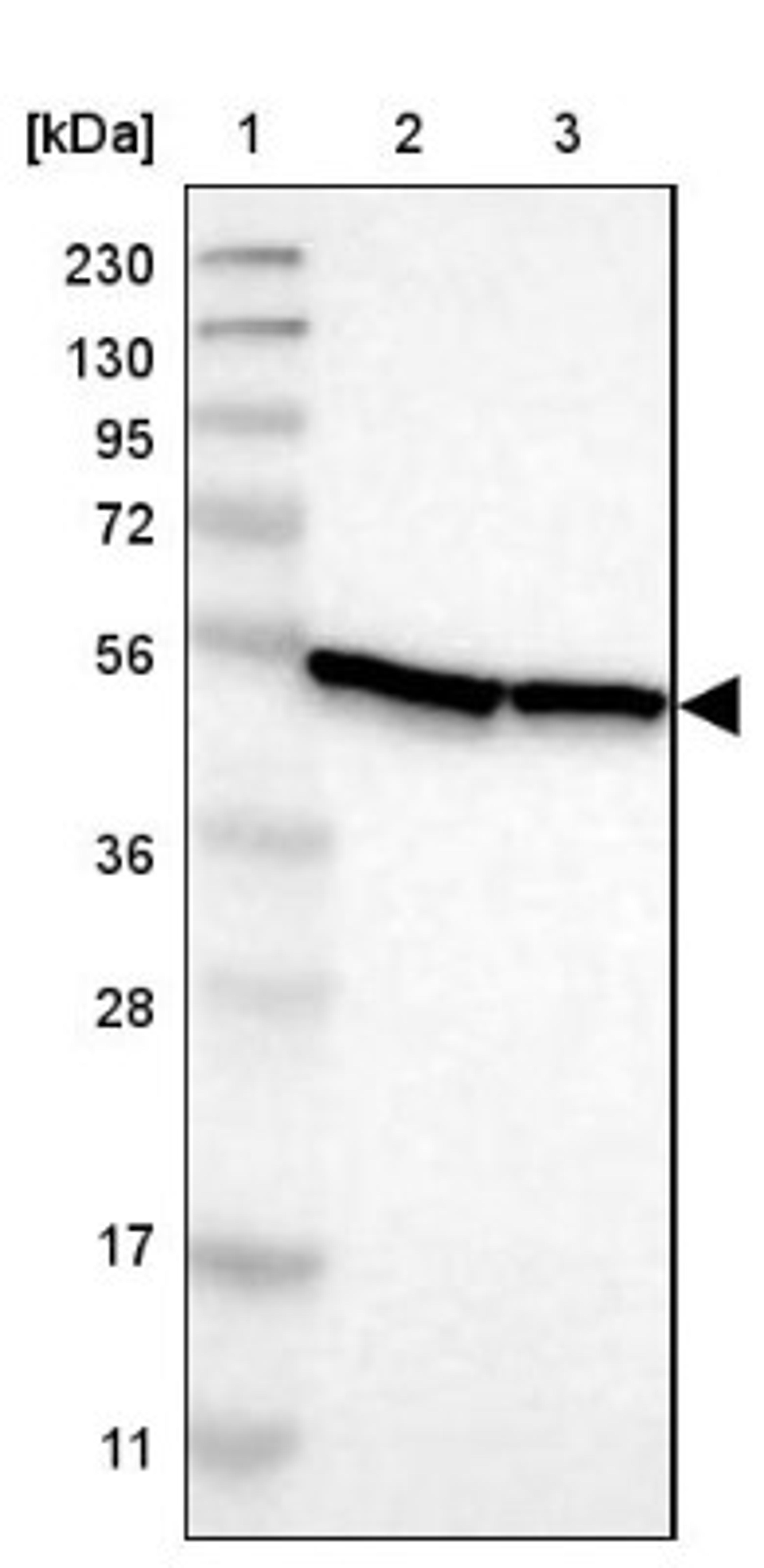 Western Blot: DDX47 Antibody [NBP1-85076] - Lane 1: Marker [kDa] 230, 130, 95, 72, 56, 36, 28, 17, 11<br/>Lane 2: Human cell line RT-4<br/>Lane 3: Human cell line U-251MG sp