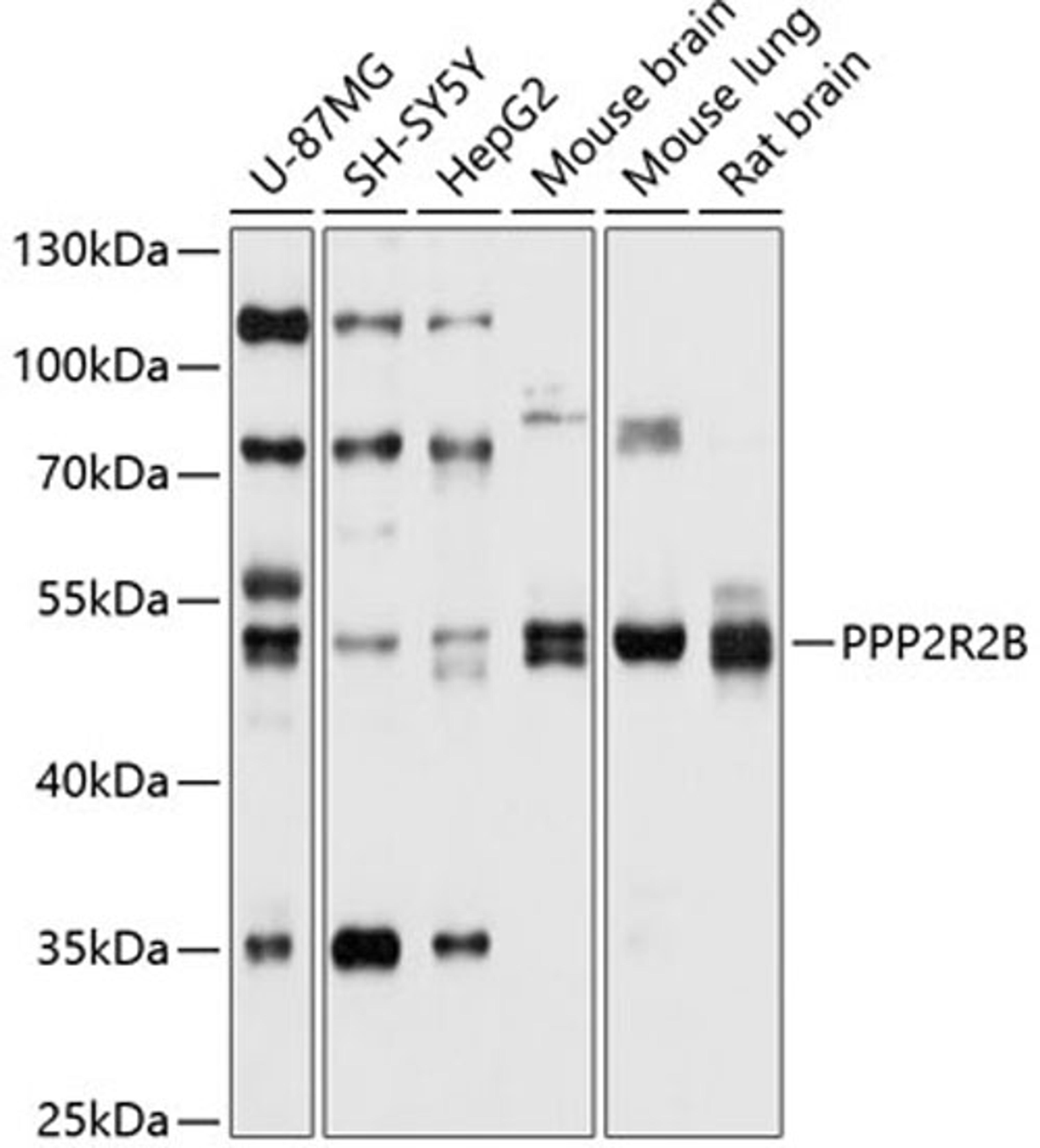 Western blot - PPP2R2B antibody (A10494)