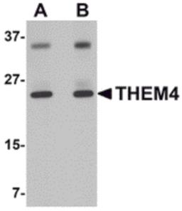 Western blot analysis of THEM4 in human liver tissue lysate with THEM4 antibody at (A) 1 and (B) 2 μg/mL.
